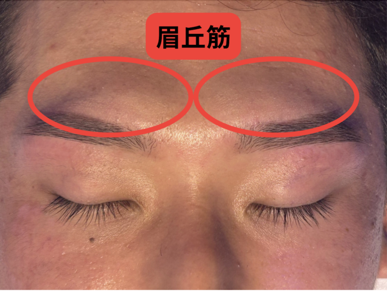 【眉サロン解説】眉毛の高さが違う5つの原因と左右非対称の治し方 | メンズのお悩み解決メディアTOPLOOK