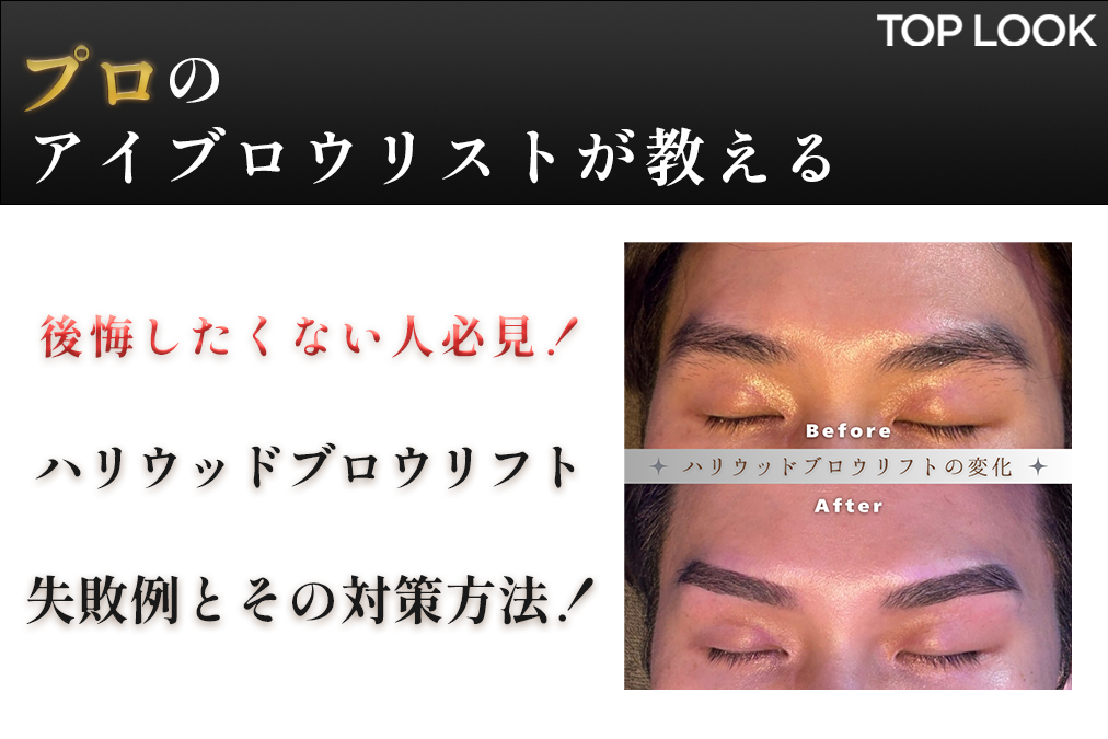 後悔したくない人必見】ハリウッドブロウリフトの失敗例と対策 