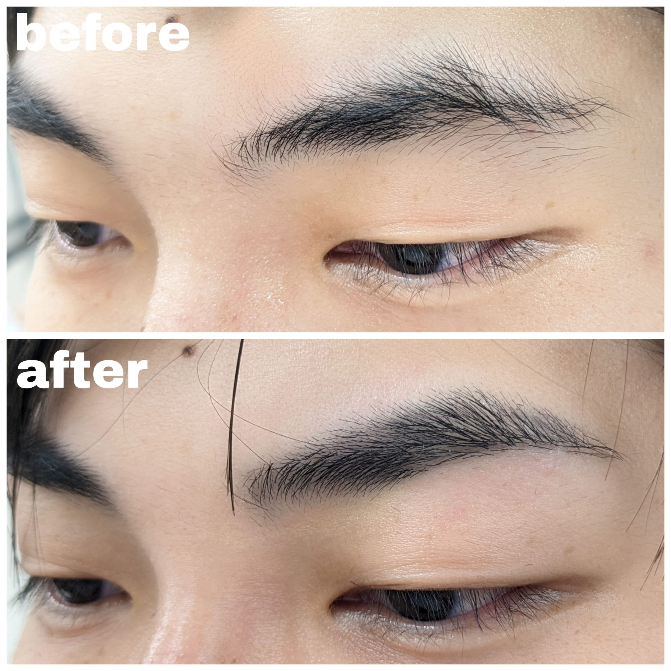 Before After 1